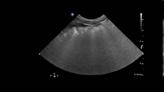 lung ultrasonography from a dog with acute pulmonary thromboembolism [upl. by Annadal]