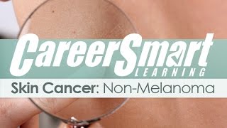 Skin Cancer NonMelanoma – Nurse – Case Manager – CRC – WC CA [upl. by Ahsenre]