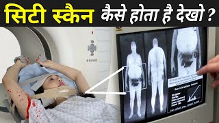 CT स्कैन कैसे होता है  CT Scan Kaise Kiya Jata Hai  CT Scan Live Video [upl. by Eem]