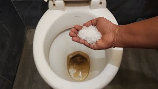 எவ்வளவு கறை இருந்தாலும் பளிச்சினு சுத்தம் ஆயிடும் Toilet basin cleaning tips cleaning tips tips [upl. by Gnahc]