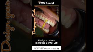 FMS Dental  Best Cosmetic Dental Clinic in Hyderabad  Smile Correction [upl. by Virginie222]