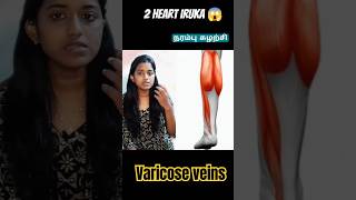 2 Heart Iruka 🙄 Kaal la heart irukuma 🥲 varicosevein information நரம்பு veindisease bams tamil [upl. by Kaleena]