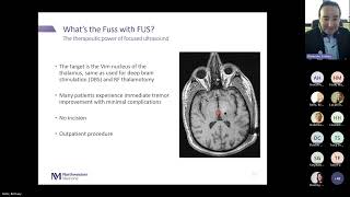 What’s the Fuss with FUS Focused Ultrasound for Essential Tremor [upl. by Sokul]