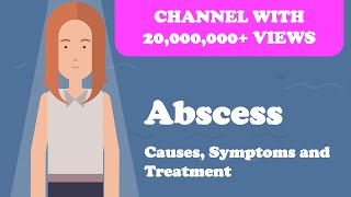 Abscess  Causes Symptoms and Treatment [upl. by Duston]