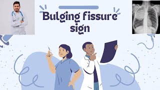 Bulging fissure sign [upl. by Mitran]