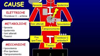 Le 3E dellarresto cardiorespiratorio ECG EGA ECO [upl. by Islaen]