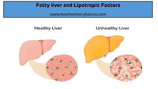 Fatty Liver  Lipotropic Factors  Causes of Fatty Liver  Biochemistry [upl. by Fairweather]