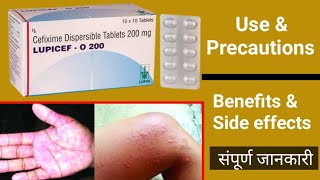 LUPICEF O tablets benefits dose amp side effects full details in hindi [upl. by Edgerton]