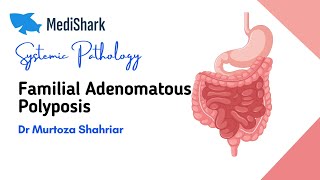 Systemic Pathology Familial Adenomatous Polyposis Dr Murtoza Shahriar [upl. by Ilyah835]