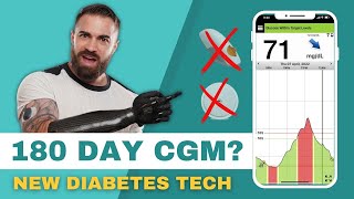 NEW Diabetes Tech  Eversense 180 day Continuous Glucose Monitormore accurate than Dexcom amp Libre [upl. by Cleti]