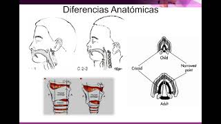 3 Oxigenoterapia y manejo de la vía aérea pediátrica [upl. by Idram402]