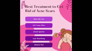 Best Treatment to Get Rid of Acne Scars [upl. by Ennayr38]