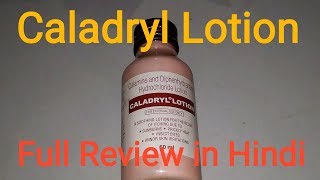 Caladryl Lotion पुरे बॉडी की खुजली से आराम तुरन्त [upl. by Ahsimak342]