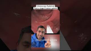 What A Colonoscopy is Really Like [upl. by Yenaffit475]