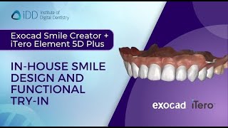 Exocad Smile Creator  iTero Element 5D Plus Inhouse Smile Design and Functional TryIn [upl. by Ramedlab836]