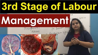 Management of Third Stage of Labour  Normal Labour  Nursing Lecture [upl. by Kir]