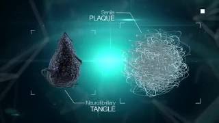 Beta amyloid and Tau proteins HUMAN transglutaminase substrates LIKE GLUTEN and CASEIN LECMA [upl. by Elamaj419]