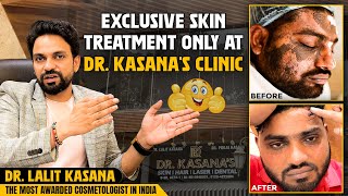 Exclusive Skin Treatment Only At DrKasanas Clinic [upl. by Einneg]