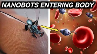 First Real NanoBots Entering The Body [upl. by Kilbride]