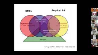 PHO training session 18062020 APPROACH TO PANCYTOPENIA [upl. by Laszlo81]