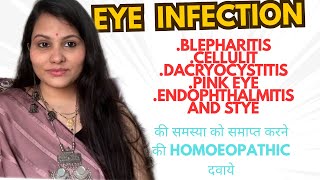 Eye Infection IrritationItching And Burning In Eye Pink Eye And Conjuctivitis DrVinita Gupta [upl. by Kra]