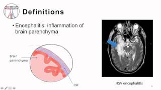 2 Bacterial Meningitis Pathogenesis and Clinical Manifestion [upl. by Ynaittirb247]