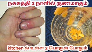 Red big finger  how to cure paronychia at home treatment  naga suthi remedy நகசுத்தி சரியாக [upl. by Etteb]