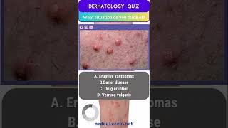 Cutaneous Signs and Diagnosis Quiz  Part 1 medicalmcqs dermatologyquiz [upl. by Eidnew208]