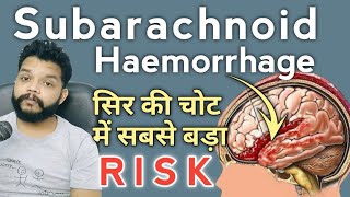 Subarachnoid Haemorrhage Kya Hota Hai  Subarachnoid haemorrhage Cause Symptoms amp Treatment Hindi [upl. by Criswell933]