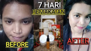 PENGALAMAN 7 HARI BEBERAPA ORANG MENGGUNAKAN TABITA SKIN CARE ORIGINAL  REAL TESTIMONI [upl. by Avle]