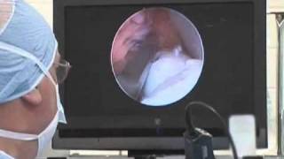 Equine Arthroscopic Surgery [upl. by Baler]