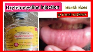 Oxytoxin injectionOxytetracyclineमुंह के छालो का इंजेक्शनOxytetracycline injection use in hindi💉 [upl. by Anitsihc]