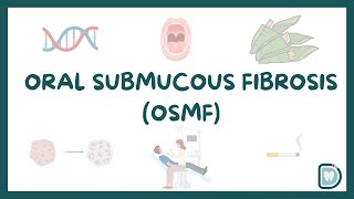 Oral Submucous Fibrosis OSMF A Comprehensive Guide for Dental Students [upl. by Burgener216]