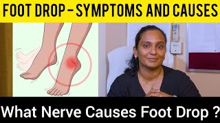 Foot Drop  पैर गिरना in Hindi लकवे के बाद पंजा नही उठने का ट्रीटमेंट  How to treat Foot Drop [upl. by Ecyoj]