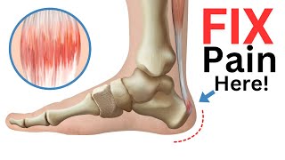 4 Exercises to Fix Achilles Tendonitis FAST [upl. by Osrock]