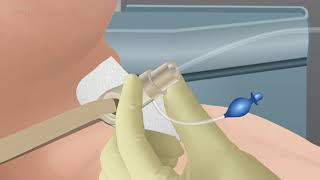 Skills Endotracheal Tube and Tracheostomy Tube Suctioning CE 3 [upl. by Heather]