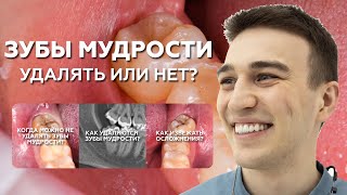 Зубы мудрости зачем удалять операция и осложнения [upl. by Bluh]