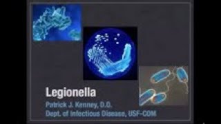 Legionella  Patrick Kenney MD [upl. by Seko203]