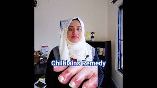 Chilblains Remedy l Toe swelling in winter l chilblains viral footcare [upl. by Aihsakal]