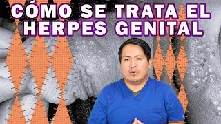 COMO ELIMINAR EL HERPES GENITAL [upl. by Thorny]