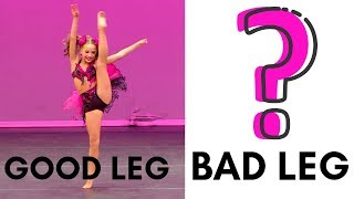 Mackenzies Bad Leg vs Good Leg Surprising [upl. by Silloc]