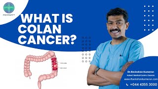 Colon Cancer Explained in Tamil  Colon Cancer Treatments  DrRavindran Kumeran  Admert Hospital [upl. by Schroth]