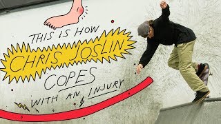 This Is How Chris Joslin Copes With An Injury [upl. by Ehcadroj227]