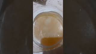 Test grossesse bicarbonate positif [upl. by Devad]