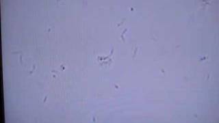 Listeria with tumbling motility [upl. by Merritt71]