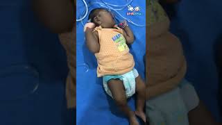 Child with microcephaly amp seizures  Pediatrics [upl. by Ymeon592]