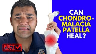 Does Knee Pain Ever Really Feel Better Once You Have Chondromalacia Patella [upl. by Aryad660]