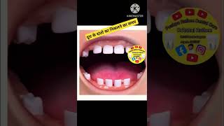 Dudh ke dant kitne hote haismilemilkteethbulls milkteethtoothdental dentistrydentistryworld [upl. by Eissat664]