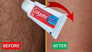 How to Make a Hair Removal Cream Using Toothpaste at Home [upl. by Leissam]