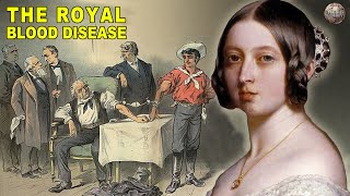 All About Hemophilia The Royal Blood Disease [upl. by Marelda]